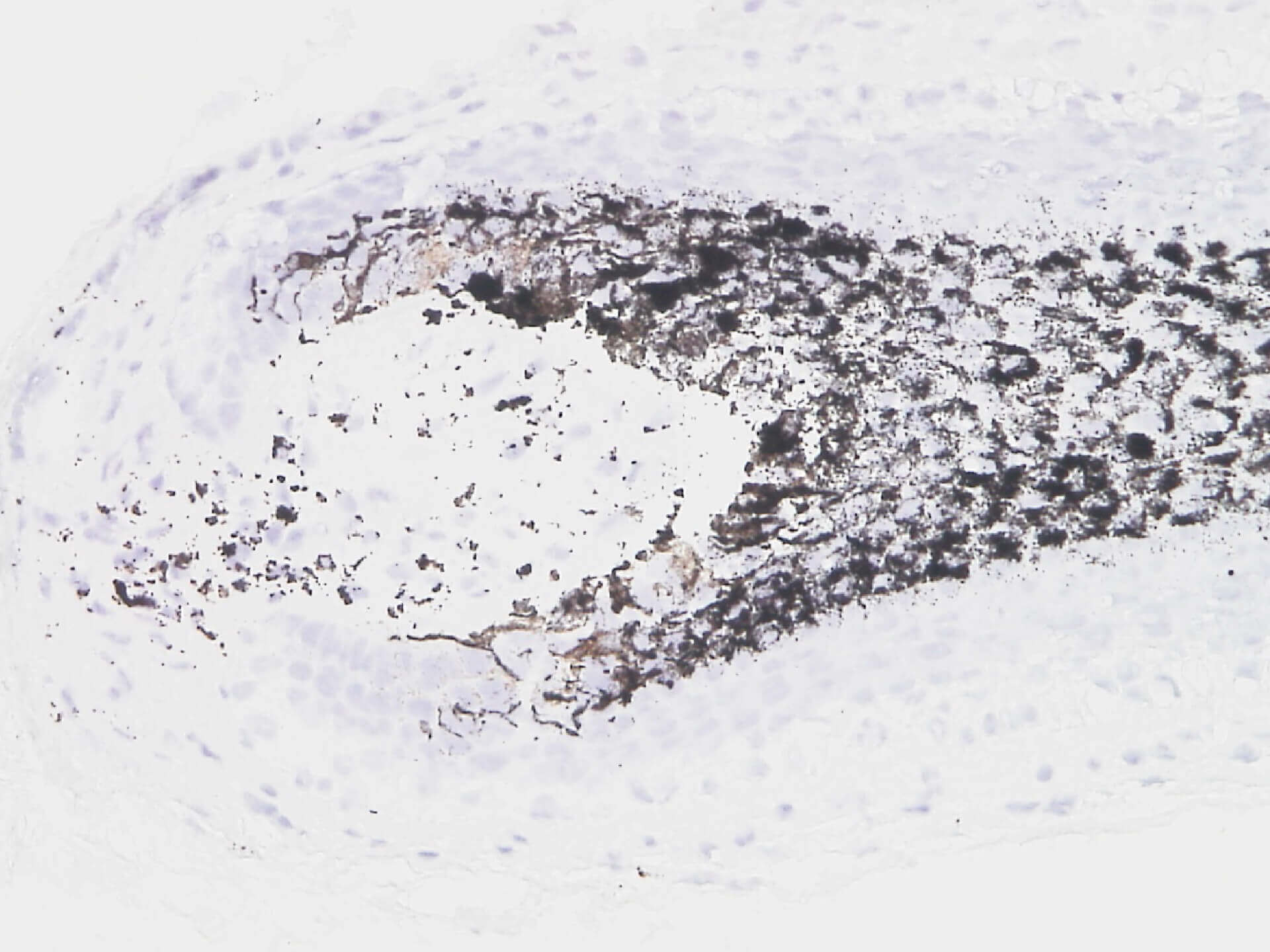 Human hair follicle organ culture - Monasterium Laboratory Human hair follicle organ culture - Monasterium Laboratory